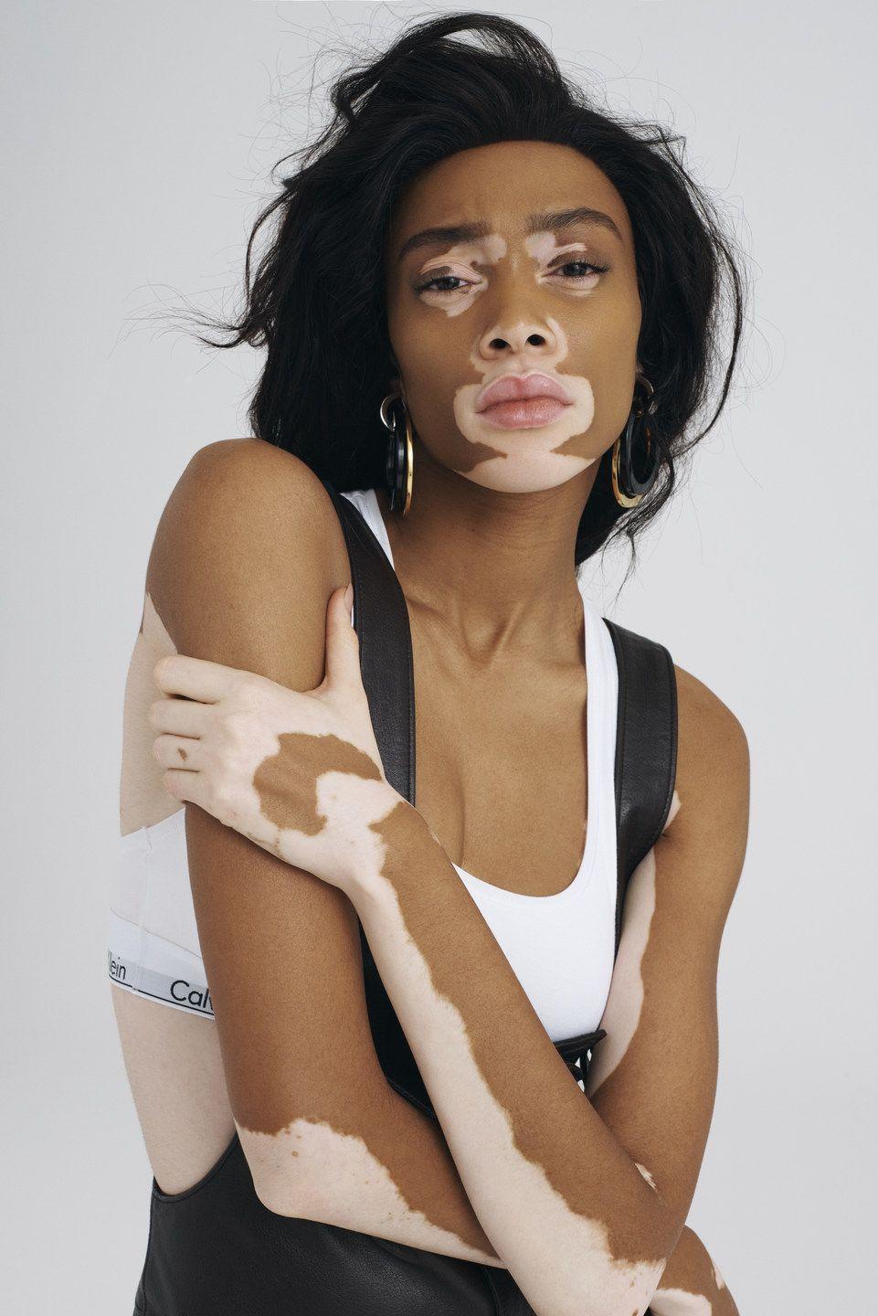 Winnie Harlow Wallpapers